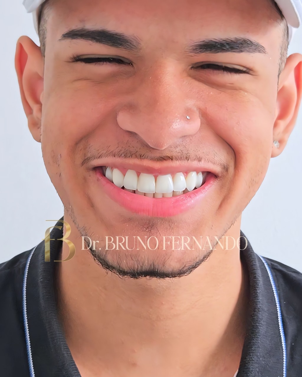 Resultado de tratamento 2