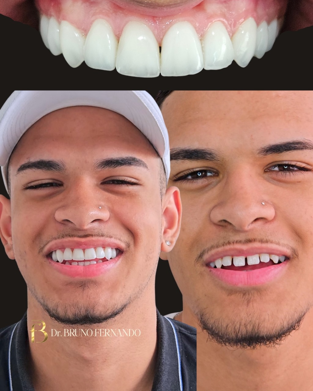 Resultado de tratamento 1