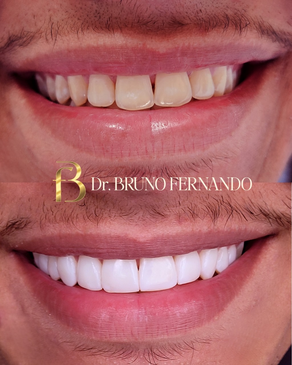 Resultado de tratamento 5