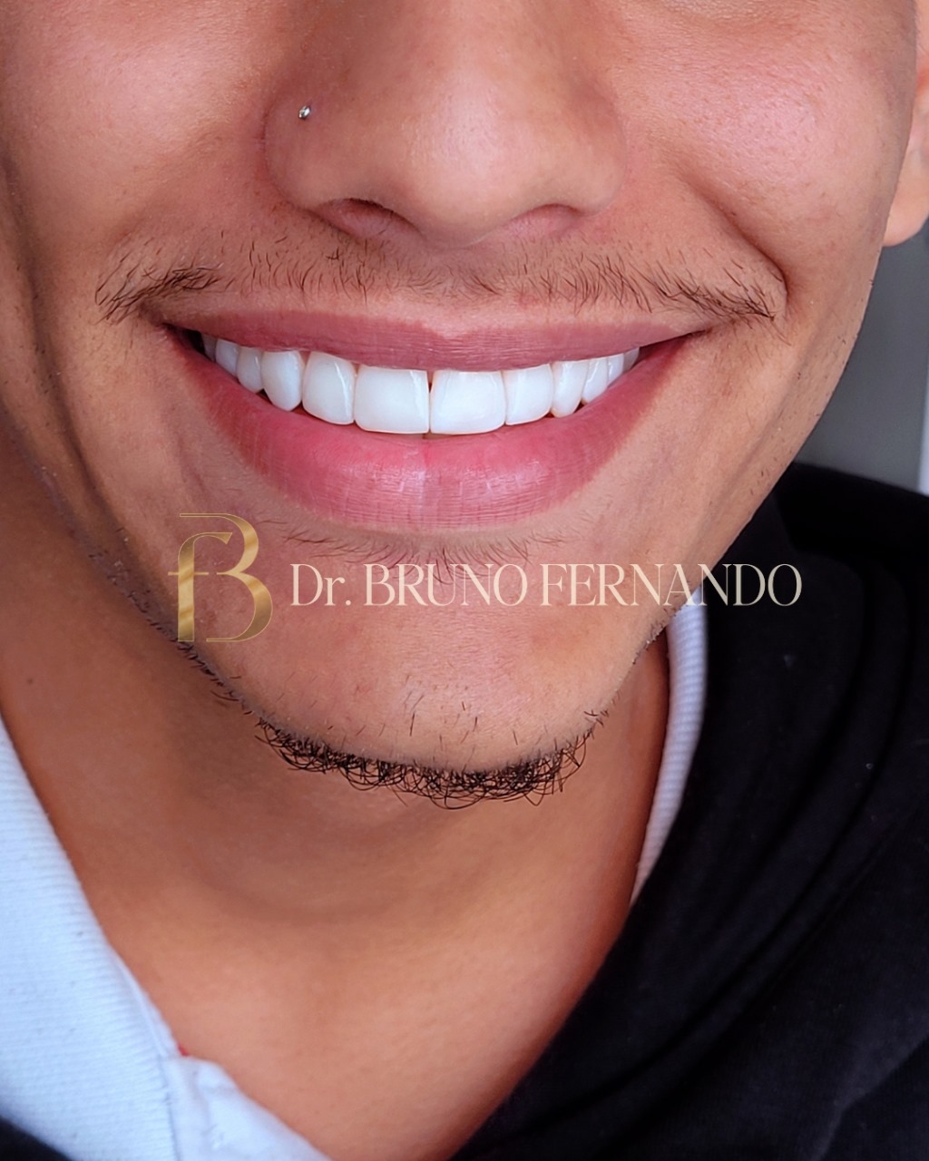 Resultado de tratamento 3